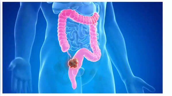 Depiction of rapid weight loss