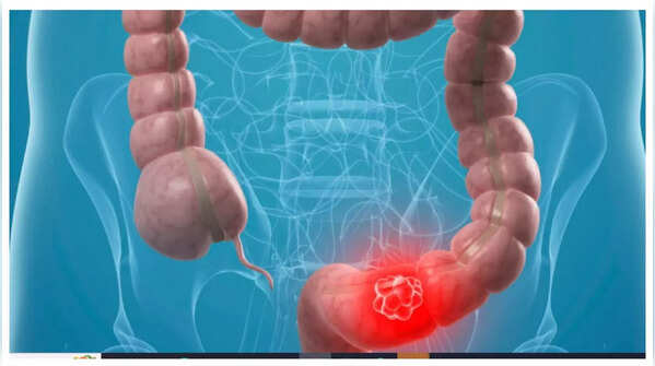 Illustration of abdominal discomfort and pain