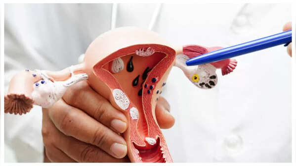 Changes in vaginal discharge can be a sign of cervical cancer