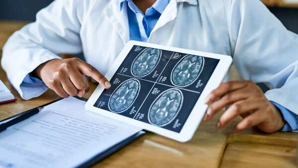 Conceptual image of the brain